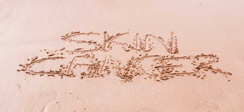 SKIN CANCER in den Sand geschrieben