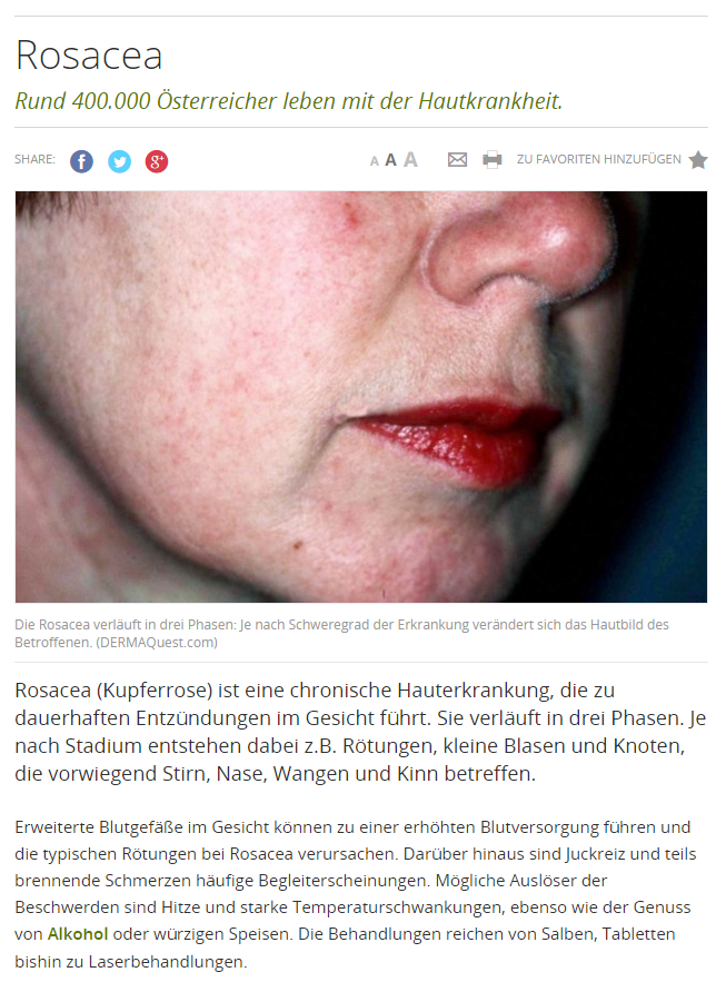 Dr. Okamoto, Hautarzt in Wien informiert über Rosacea