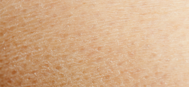 Behandlung trockener Haut in Wien - Hautarzt Prof. Dr. Okamoto