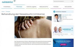 Hautarzt Dr. Okamoto in Wien - Experte auf Netdoktor - Behandlung von Nesselsucht