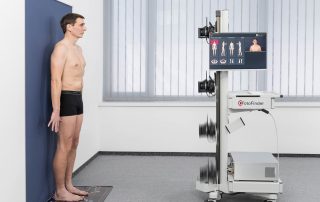 Bodyscan zur Diagnose von Melanomen (Hautrkebs) bei Hautarzt Dr. Okamoto