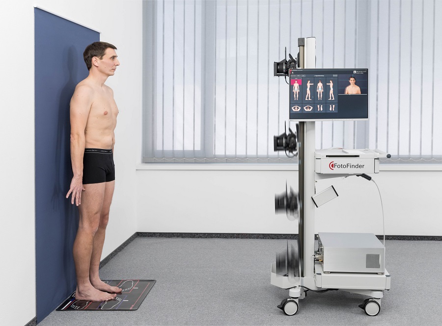 Bodyscan zur Diagnose von Melanomen (Hautrkebs) bei Hautarzt Dr. Okamoto